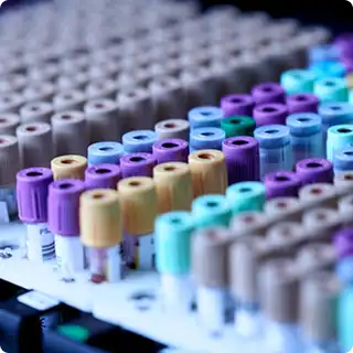 A collection of test tubes in a laboratory